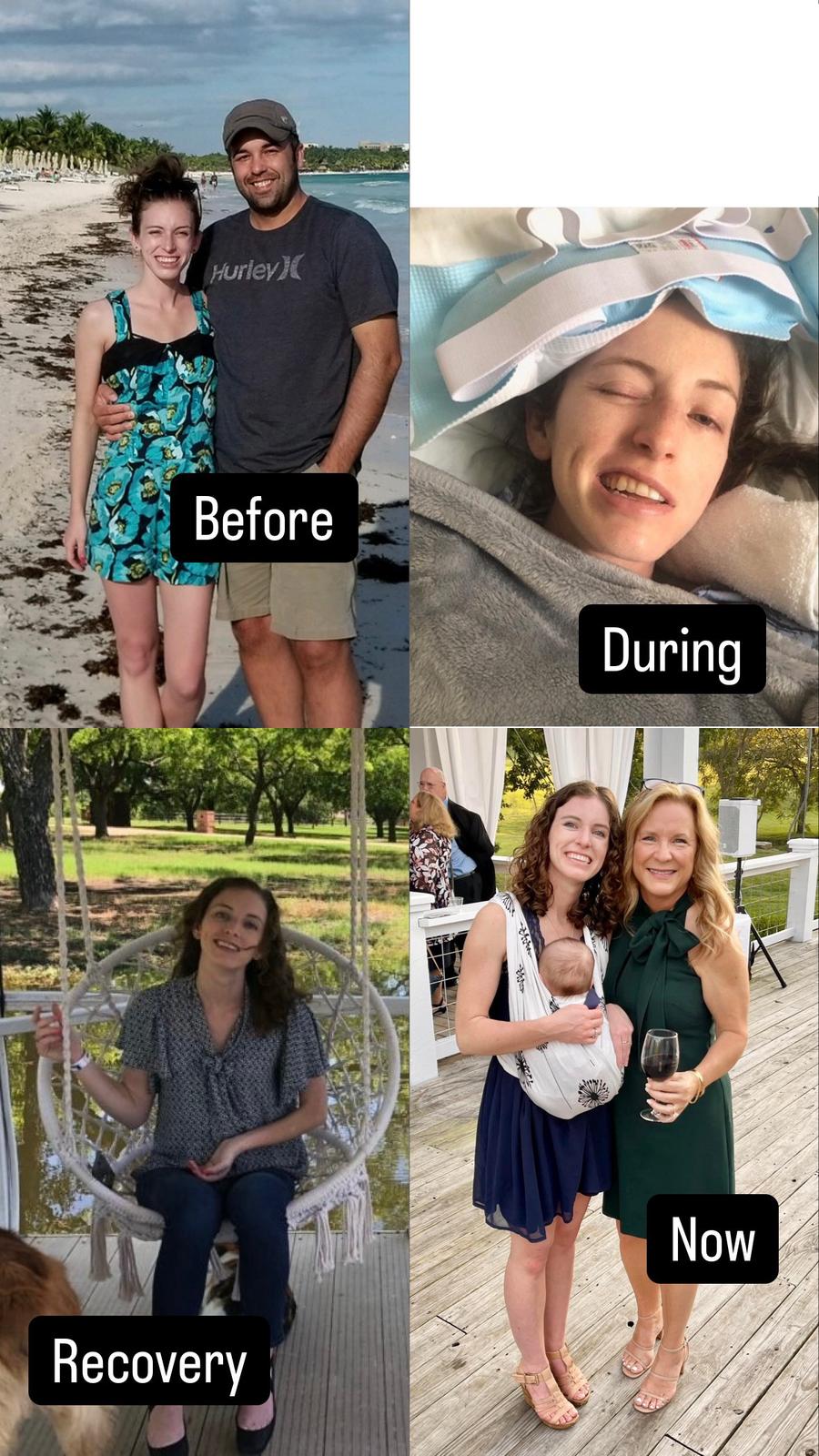 Rachel Ischemic Survivor